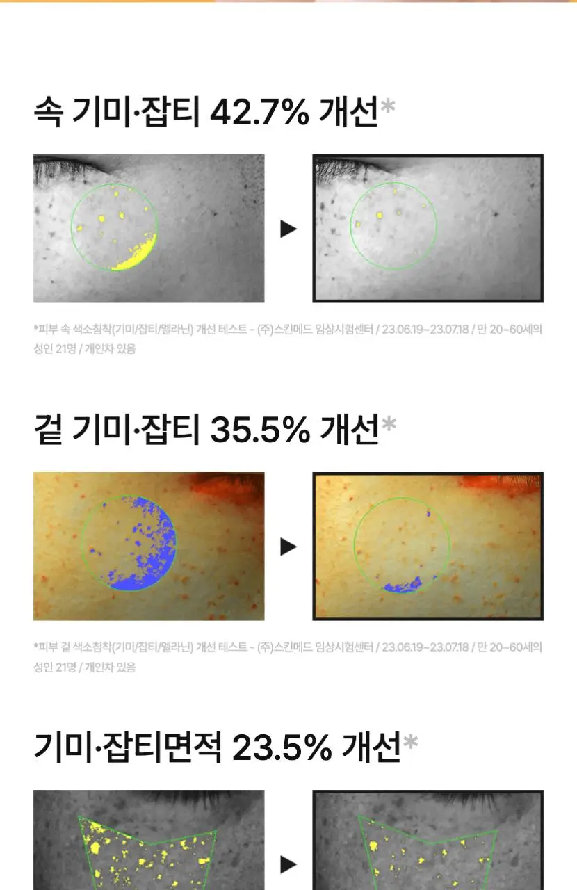 [TXA] 셀리맥스 트라넥삼산 브라이트닝 잡티 세럼 30ml 기획 (+10ml) 상세페이지 27